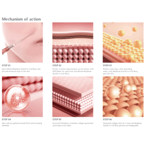 REJUBEAU STYLISH LE CIEL ROSY Poly L-Lactic Acid Injectable PLLA Derma Filler REJUBEAU STYLISH LE CIEL ROSY Poly L-Lactic Acid Injectable PLLA Derma Filler